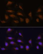 RSK1 Antibody in Immunocytochemistry (ICC/IF)