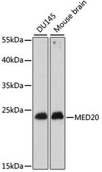 MED20 Antibody in Western Blot (WB)