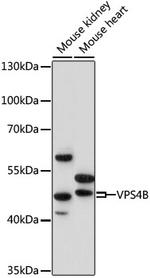 VPS4B Antibody in Western Blot (WB)