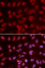 SIN3A Antibody in Immunocytochemistry (ICC/IF)