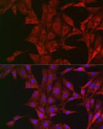 Bim Antibody in Immunocytochemistry (ICC/IF)