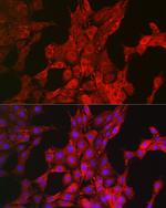 Bim Antibody in Immunocytochemistry (ICC/IF)