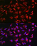 Bim Antibody in Immunocytochemistry (ICC/IF)