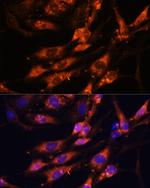 TENM1 Antibody in Immunocytochemistry (ICC/IF)