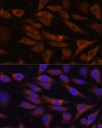 UNC13B Antibody in Immunocytochemistry (ICC/IF)