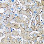 UNC13B Antibody in Immunohistochemistry (Paraffin) (IHC (P))