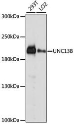 UNC13B Antibody in Western Blot (WB)