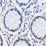 GCAT Antibody in Immunohistochemistry (Paraffin) (IHC (P))