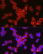 CD11b Antibody in Immunocytochemistry (ICC/IF)