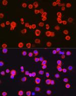 CD11b Antibody in Immunocytochemistry (ICC/IF)