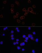 CD11b Antibody in Immunocytochemistry (ICC/IF)