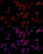 CD11b Antibody in Immunocytochemistry (ICC/IF)