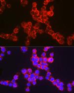 CD11b Antibody in Immunocytochemistry (ICC/IF)