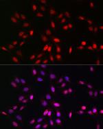 UFM1 Antibody in Immunocytochemistry (ICC/IF)