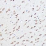 UFM1 Antibody in Immunohistochemistry (Paraffin) (IHC (P))