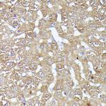 CDK5RAP1 Antibody in Immunohistochemistry (Paraffin) (IHC (P))