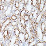 CDK5RAP1 Antibody in Immunohistochemistry (Paraffin) (IHC (P))