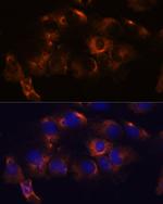 ATL2 Antibody in Immunocytochemistry (ICC/IF)