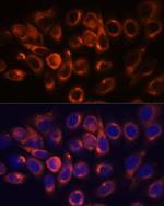 ATL2 Antibody in Immunocytochemistry (ICC/IF)