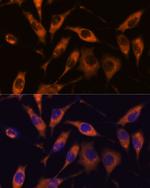 ATL2 Antibody in Immunocytochemistry (ICC/IF)