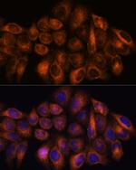 MMP25 Antibody in Immunocytochemistry (ICC/IF)