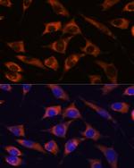 MMP25 Antibody in Immunocytochemistry (ICC/IF)