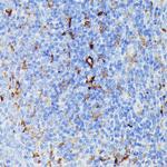 MMP25 Antibody in Immunohistochemistry (Paraffin) (IHC (P))