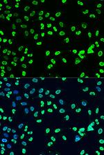 Di-Methyl-DNMT3A (Lys44) Antibody in Immunocytochemistry (ICC/IF)