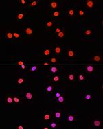 Di-Methyl-DNMT3A (Lys44) Antibody in Immunocytochemistry (ICC/IF)