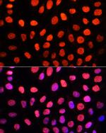 Di-Methyl-DNMT3A (Lys44) Antibody in Immunocytochemistry (ICC/IF)