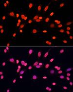 Di-Methyl-DNMT3A (Lys44) Antibody in Immunocytochemistry (ICC/IF)