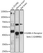 GABRB1 Antibody in Western Blot (WB)