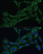 ETFB Antibody in Immunocytochemistry (ICC/IF)