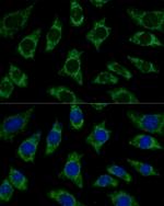 ETFB Antibody in Immunocytochemistry (ICC/IF)