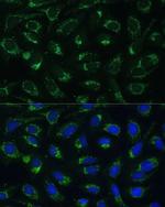 ETFB Antibody in Immunocytochemistry (ICC/IF)