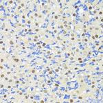 TRIM27 Antibody in Immunohistochemistry (Paraffin) (IHC (P))