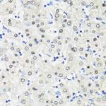 TRIM27 Antibody in Immunohistochemistry (Paraffin) (IHC (P))