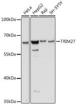 TRIM27 Antibody in Western Blot (WB)