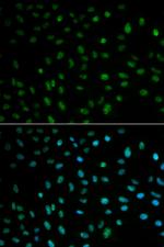 HuR Antibody in Immunocytochemistry (ICC/IF)