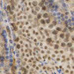 HuR Antibody in Immunohistochemistry (Paraffin) (IHC (P))