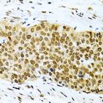 HuR Antibody in Immunohistochemistry (Paraffin) (IHC (P))