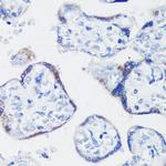 KISS1 Antibody in Immunohistochemistry (Paraffin) (IHC (P))