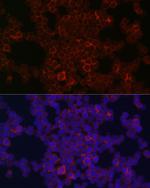 CSF1R Antibody in Immunocytochemistry (ICC/IF)