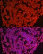 CSF1R Antibody in Immunocytochemistry (ICC/IF)