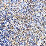 14-3-3 gamma Antibody in Immunohistochemistry (Paraffin) (IHC (P))