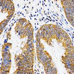 PIBF1 Antibody in Immunohistochemistry (Paraffin) (IHC (P))