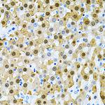 PIBF1 Antibody in Immunohistochemistry (Paraffin) (IHC (P))