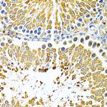 PIBF1 Antibody in Immunohistochemistry (Paraffin) (IHC (P))