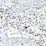 Gemin 2 Antibody in Immunohistochemistry (Paraffin) (IHC (P))