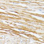 TPM2 Antibody in Immunohistochemistry (Paraffin) (IHC (P))